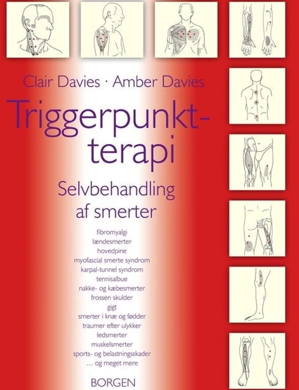 Triggerpunkt-terapi: Selvbehandling af smerter (Bog, Hæftet, Dansk) af Clair Davies